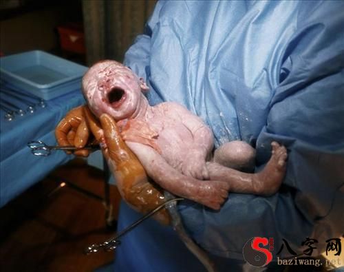 梦见生孩子大出血